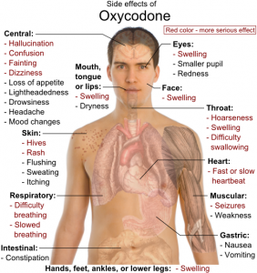 Oxycodone Side Effects